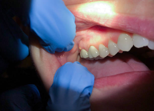 Best Emergency Dentist Near Me  in Royal Pines, NC
